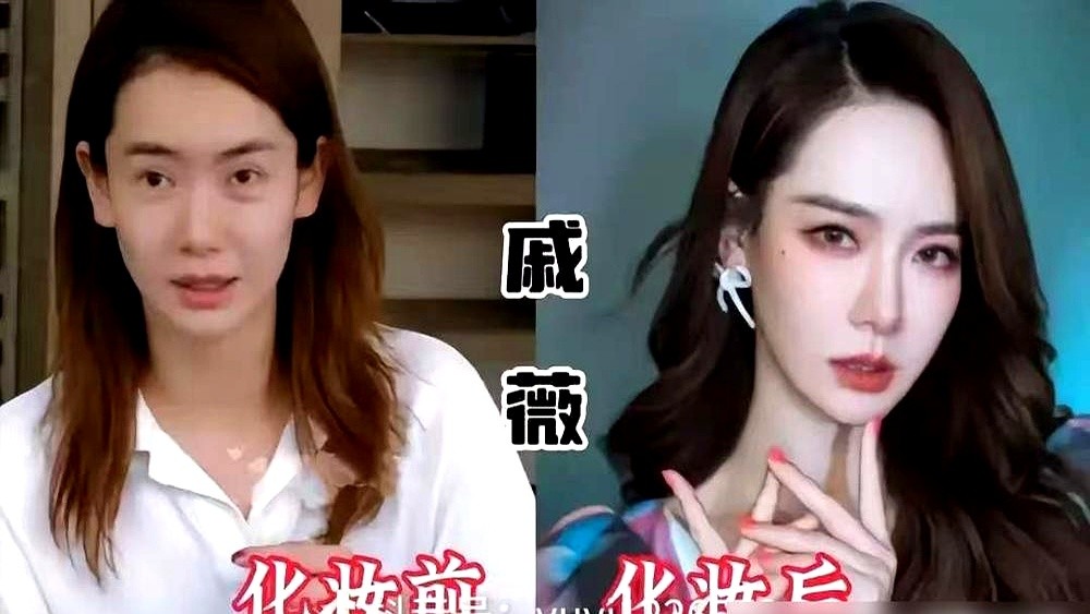 连续四年做光电、溶掉脸上的玻尿酸，沈梦辰现在比她二十几岁时还要紧致。当年那张黑黄皮素颜照爆出，全网笑