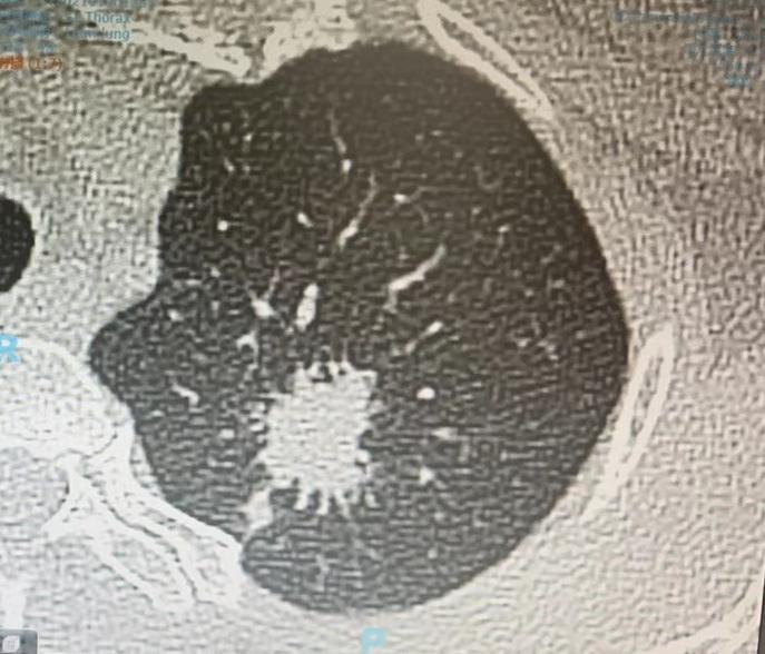 门诊来了一对夫妻，先生50岁上下，坐在那儿一声不吭，脸色沉沉的。他太太站在身后，
