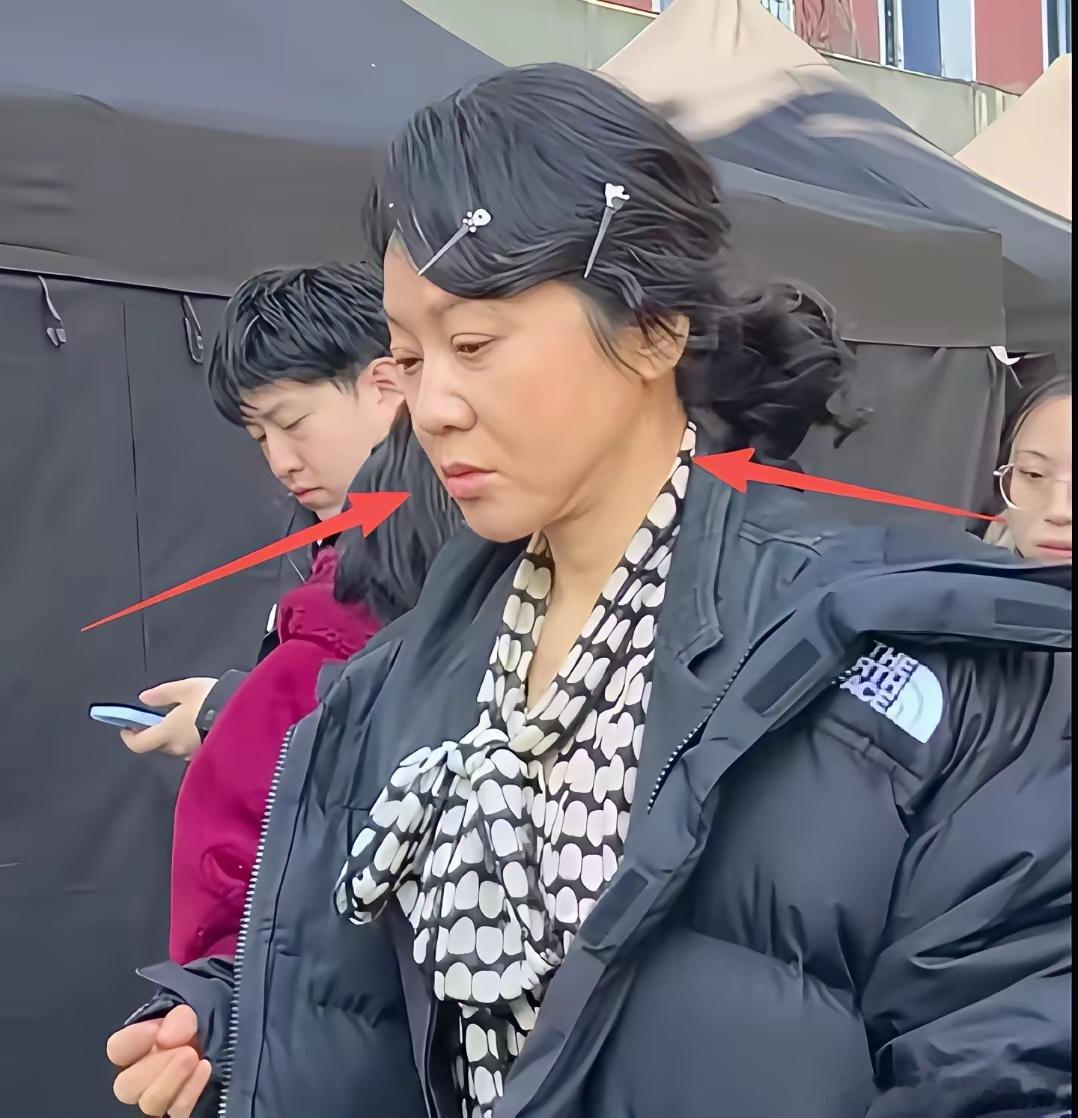 54岁闫妮现身沈阳街头，脸肿馒化皮肉松垮，被路人拍照眼神犀利。​​​