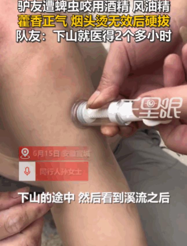 太可怕了！安徽宣城，一男子徒步至半山腰时，不幸被蜱虫紧紧咬住。因下山就医需两小时