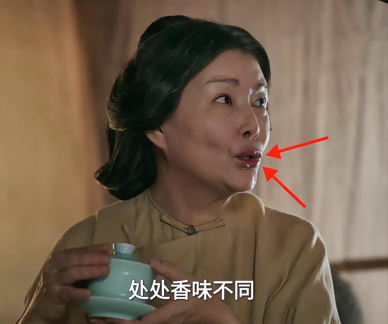 《大生意人》里饰演古平原母亲的朱茵给所有女演员提了个醒！医美后遗症会影响演技表达