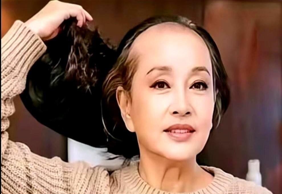 75岁的刘晓庆当着两百多号人的面，抬手把戴了三十年的定制假发扯了下来。花白的发根露在聚光灯底下，头皮