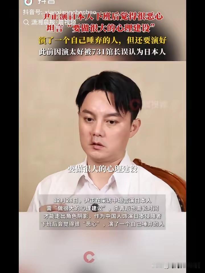 尹正这嘴怎么啦？看起来好像真的一样。尹正是金子总会发光，尹正演技很好，但是他不