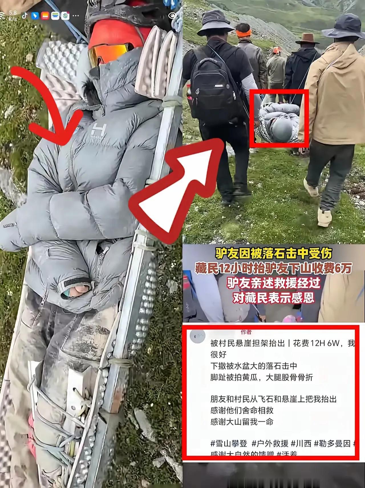 终于弄明白了，骨折女孩为什么同意6万块下山了，不是讹钱，而是她真的没第二条路可选