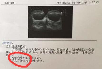 孕期B超单透露的重要信息! 教你看懂9大关键指标
