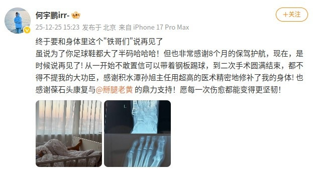 何宇鹏社媒晒摘除左足钢板照: 终于和身体里这个“铁哥们”说再见