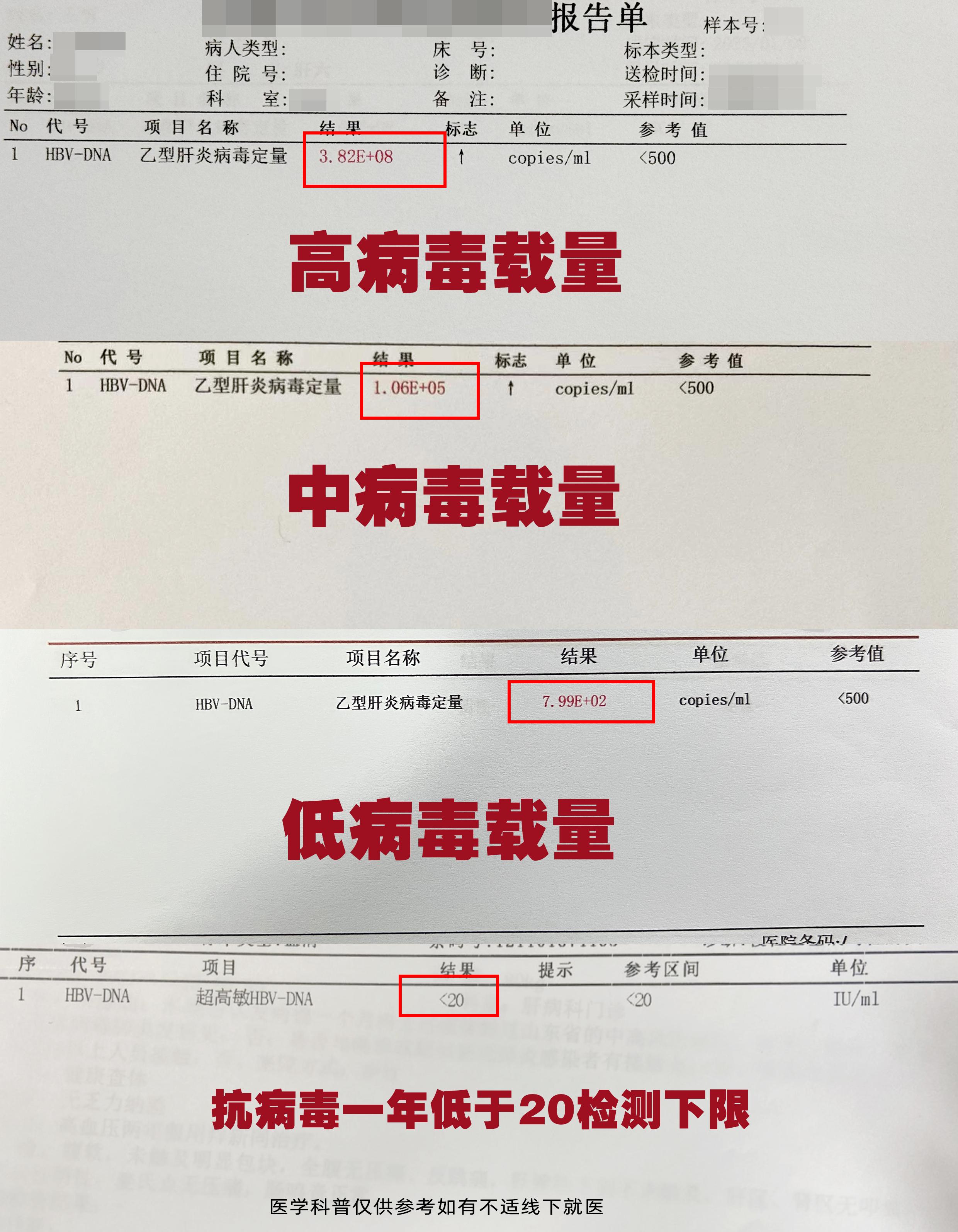 乙肝病毒量低于多少才安全？  过去，不少人觉得乙肝病毒量小于 1000...