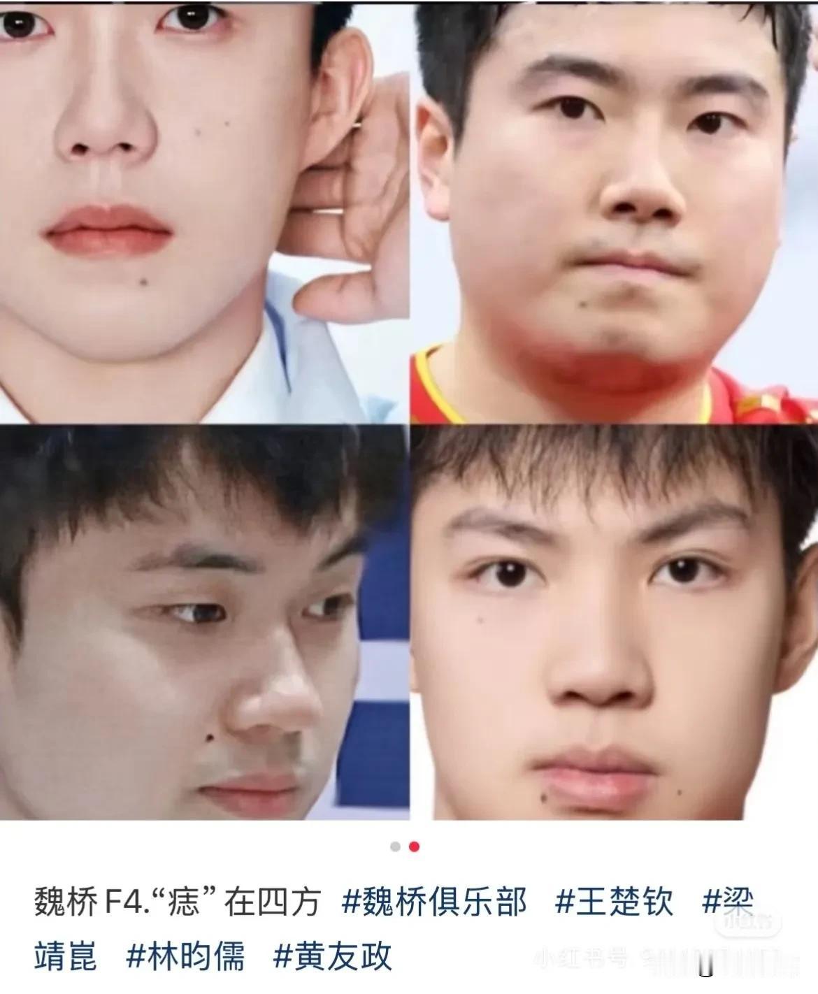 魏桥F4!好男儿“痣”在四方！真的在四方啊[捂脸哭]这都被发现了！魏桥只要有痣青