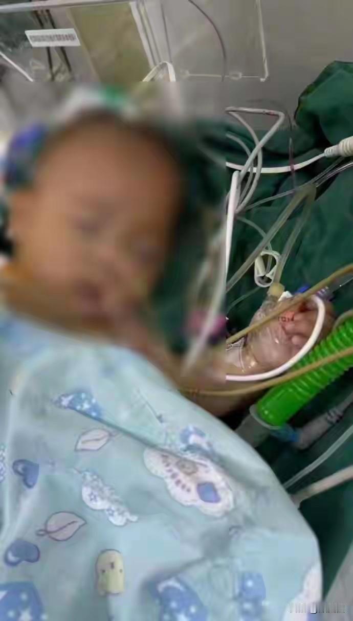 5个月大的宝宝做完心脏手术就走了，眼角还挂着泪，这场手术到底哪儿出问题了？宁波