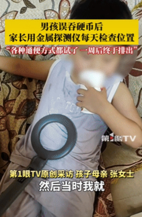 “是个聪明人！”河南郑州，一男孩拿着1元硬币，不小心咽下去了，家长发现后立马带着