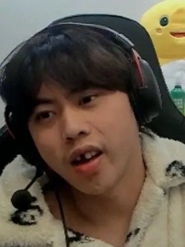 阿乐，你门牙咋没了？德杯结束后，Ale首次开启直播露脸，结果满屏都是问号，画面里