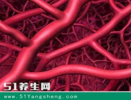 造成血管堵塞的“真凶”找到了, 两个方法给血管“洗洗澡”