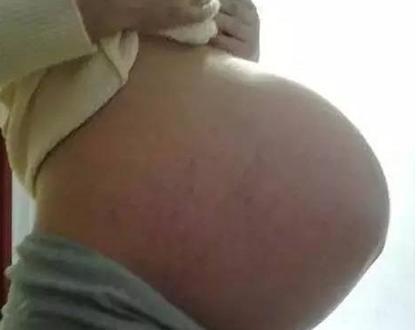 为生儿子就要拿自己的生命开玩笑吗? 这位产妇真无知