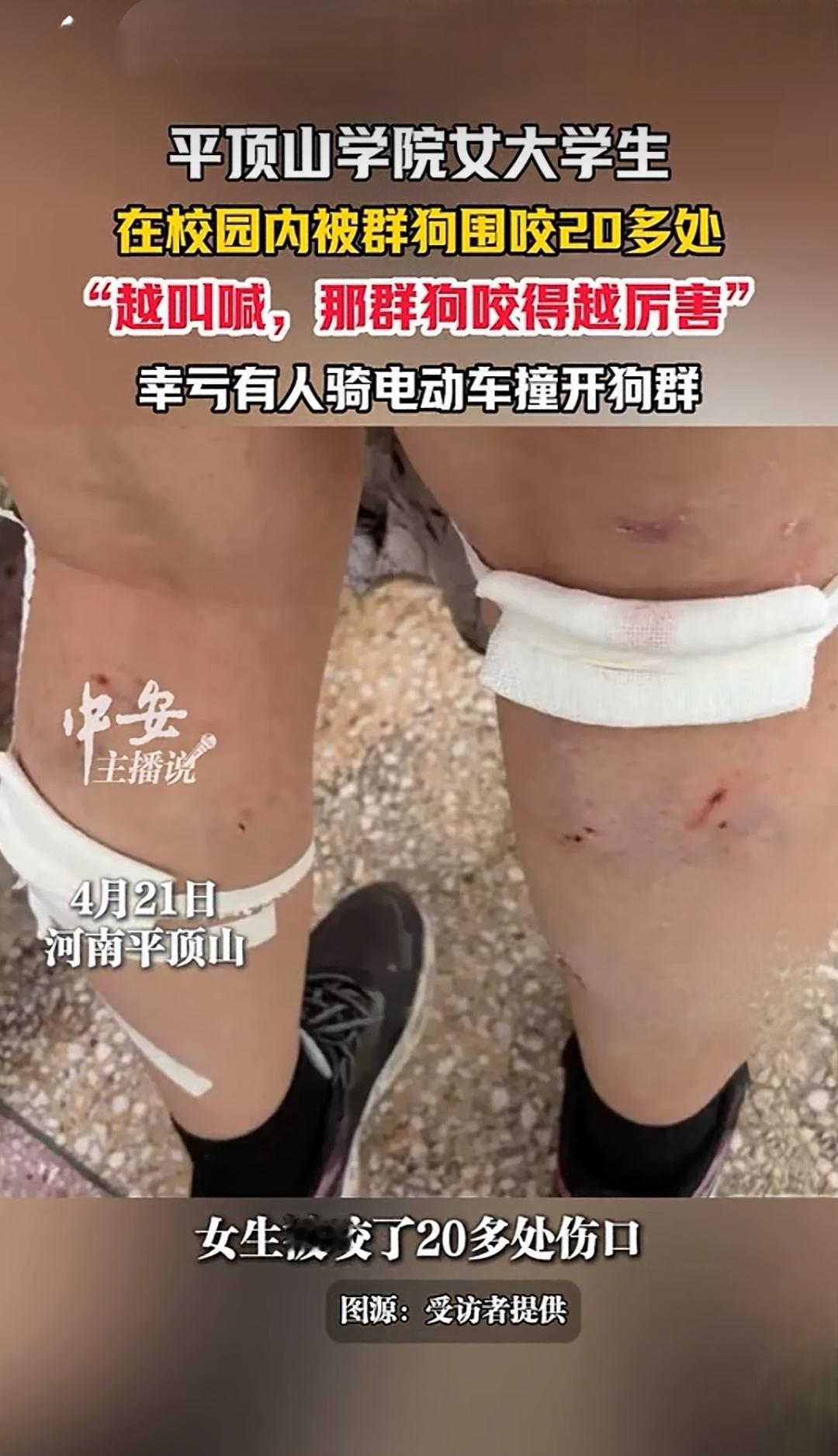 爱狗人士再度选择了沉默与逃避。一名女大学生在校园内被流浪狗咬伤，身上留下20多