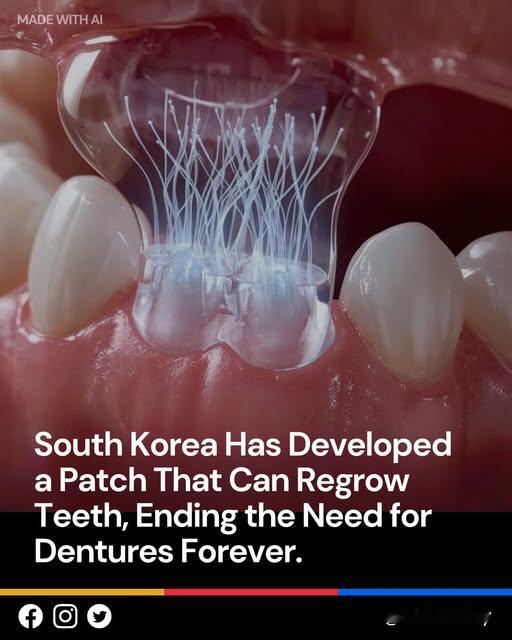 韩国科学家公布重大牙科突破：微型生物活性贴片可实现牙齿自然再生，或终结假牙时代韩