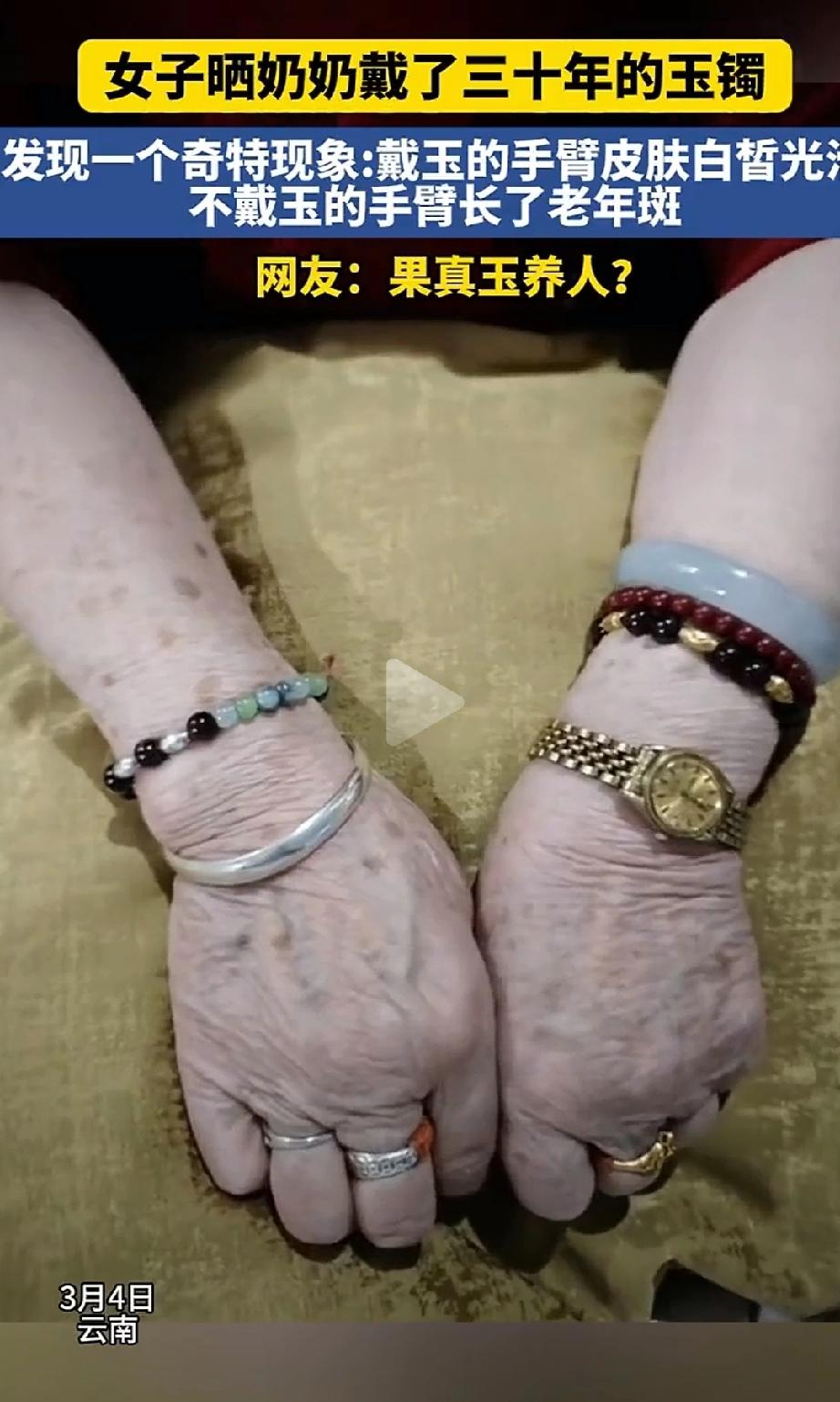 解释不清了！云南一位奶奶戴了30年的云南玉手镯，出现了神奇现象：戴手镯的那只手皮