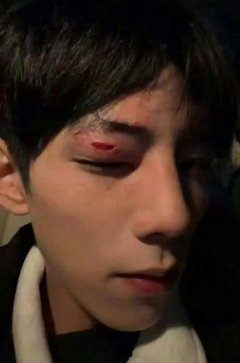 哎呀妈呀短国拍戏真打啊，这俩是不是有私仇