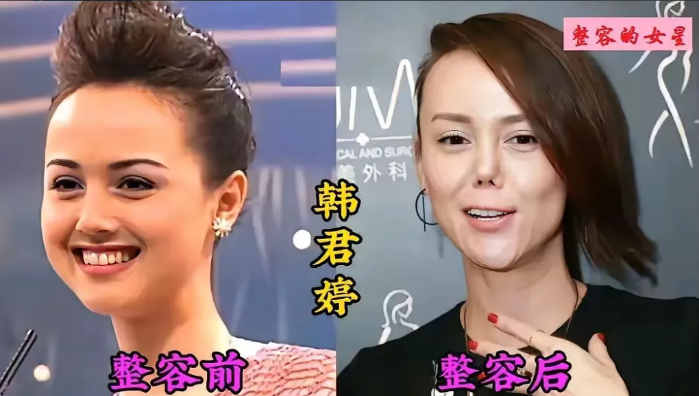 千万别随意整容！看看韩君婷便知，她的整容堪称毁容啊！没整容时，她脸型饱满、五