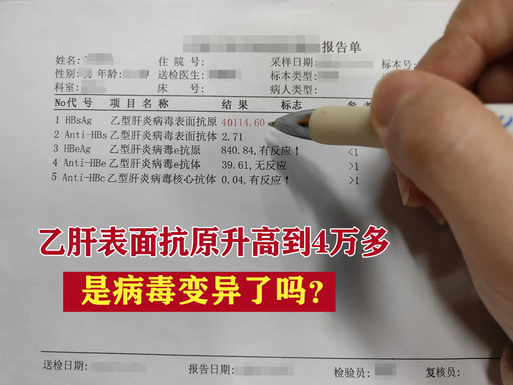 乙肝表面抗原升高到4万，是病毒变异了吗？ “我没吃抗病毒药前，乙肝表面...