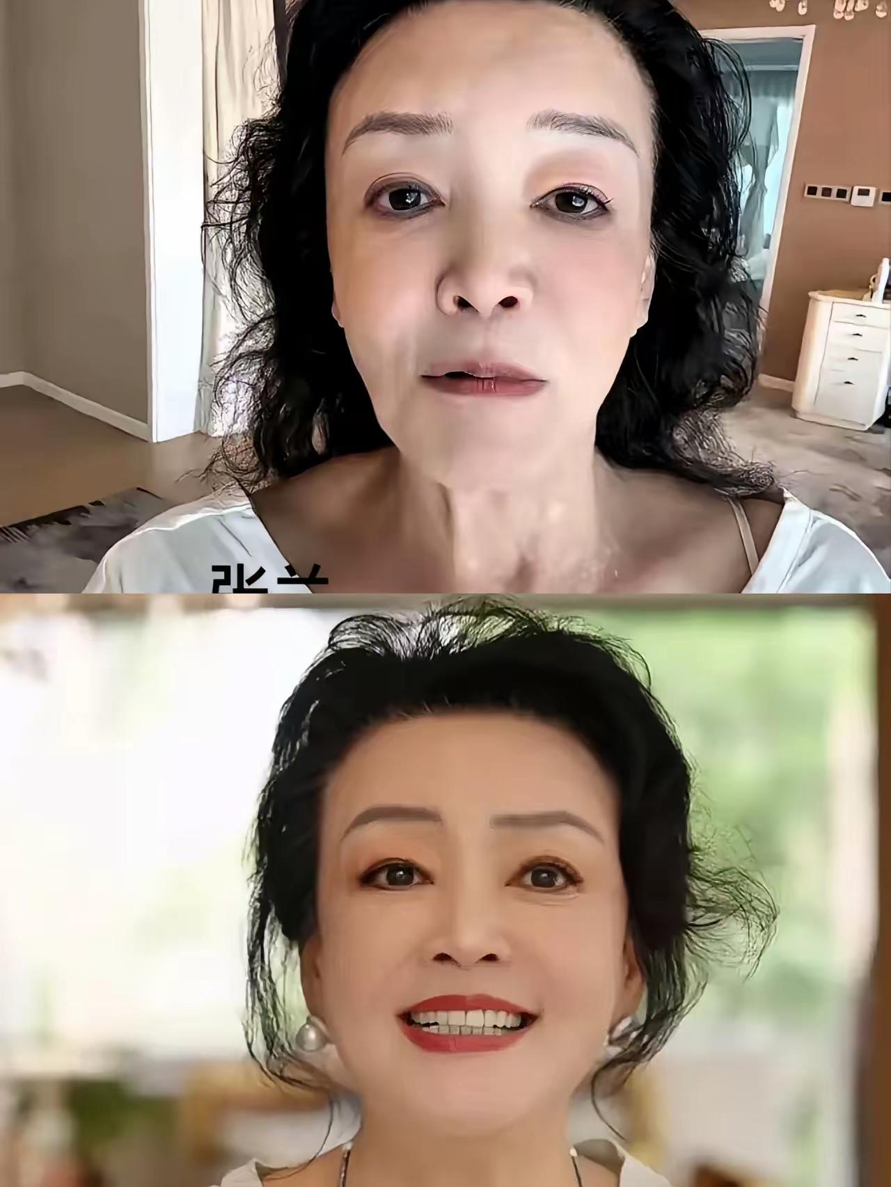 人到中老年，真别玩命减肥。​看看张兰的对比就看得出来，脸上有点肉，脸蛋是饱满的