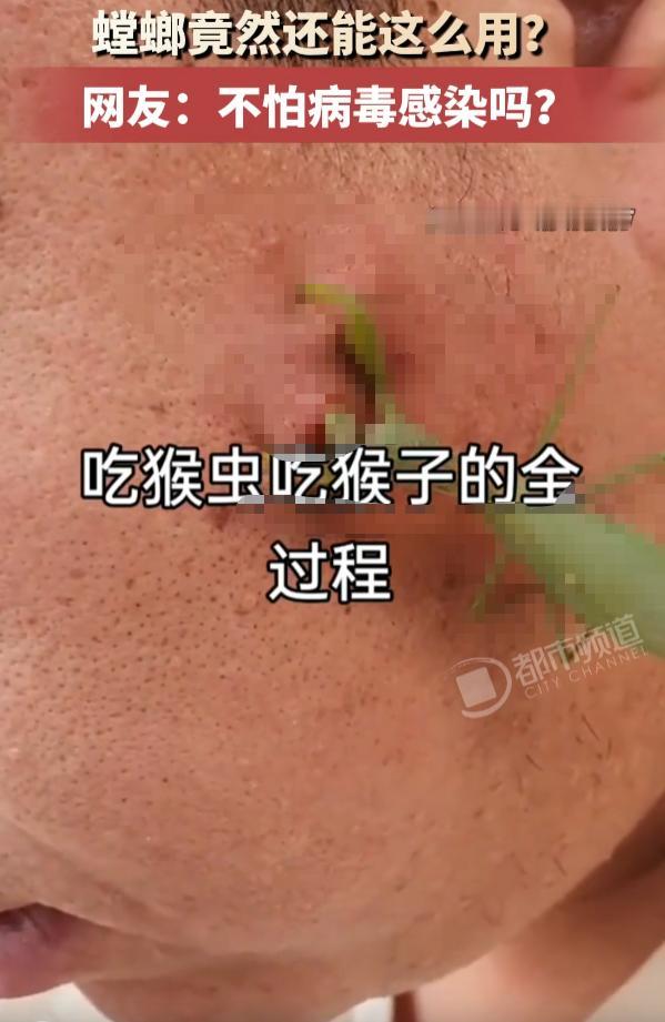 山西，一男子打算去掉脸上的瘊子，想出偏方让螳螂趴在脸上啃。螳螂不停吸食瘊子，看着