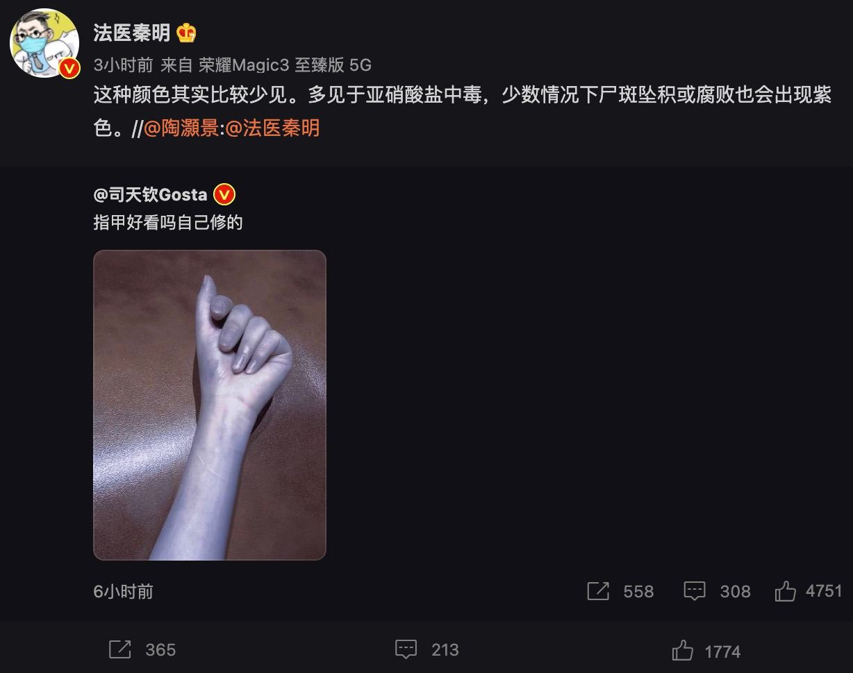你这个肤色有点瘆人啊