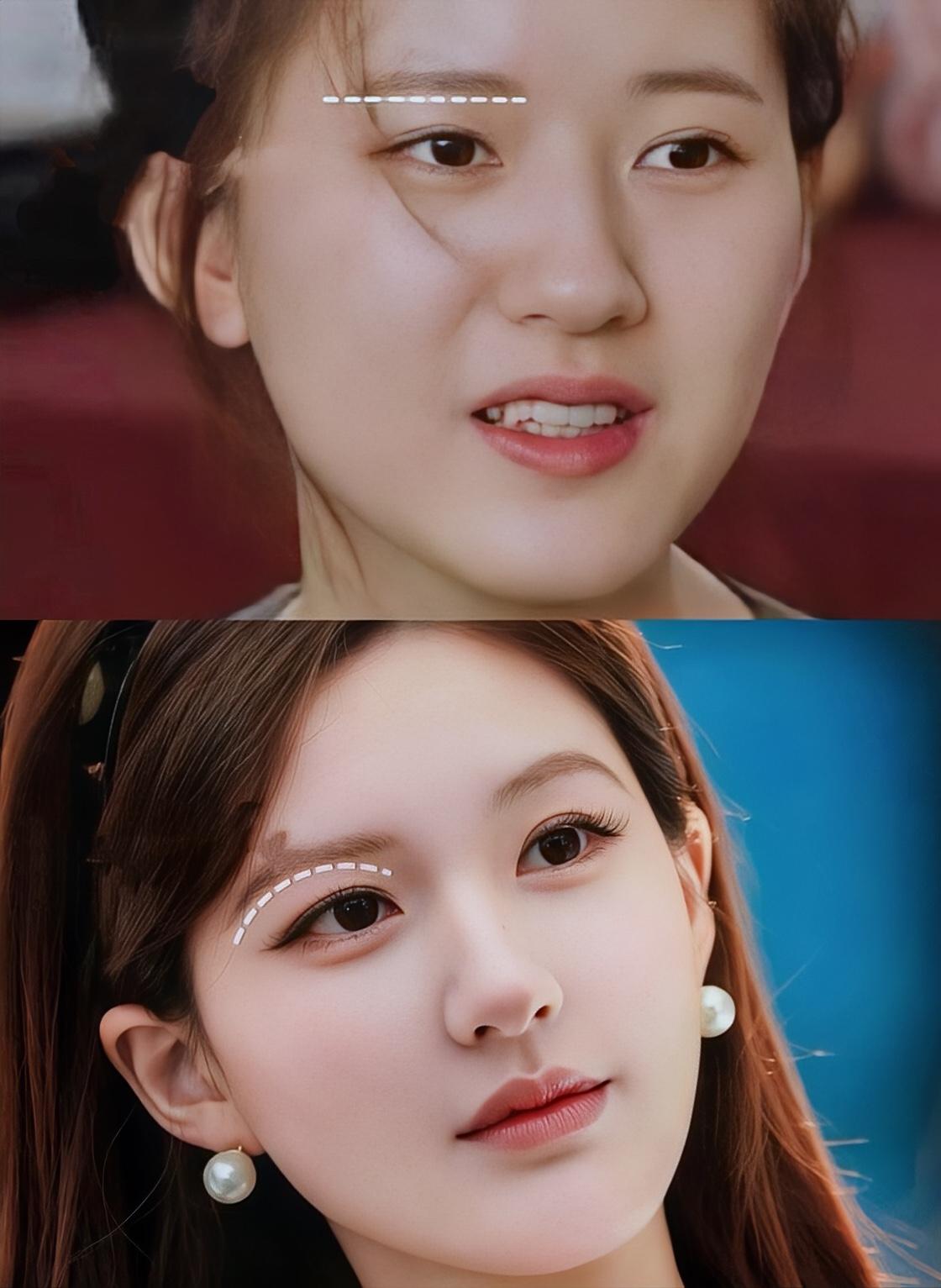 大家都没感觉．她嘴变好看了吗