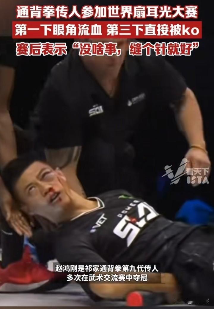 赵鸿刚被打的满脸是血，输了印度看到评论后眼睛亮了，赢学呀以后再被小巴干了就到