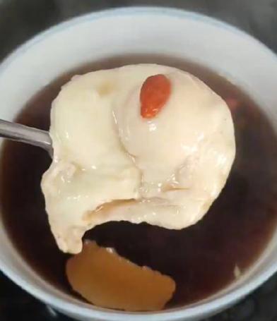 肺结节别慌！一个小方子，助你消散结节50岁的夏女士咳嗽、胸痛，一查发现0.