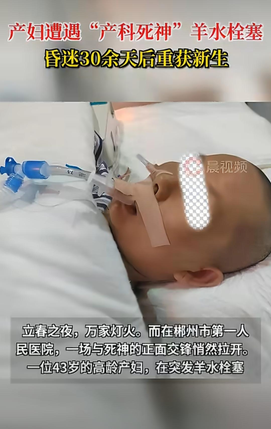43岁产妇遭遇产科死神，昏迷三十余天终苏醒一位43岁的高龄产妇，在分娩时遭