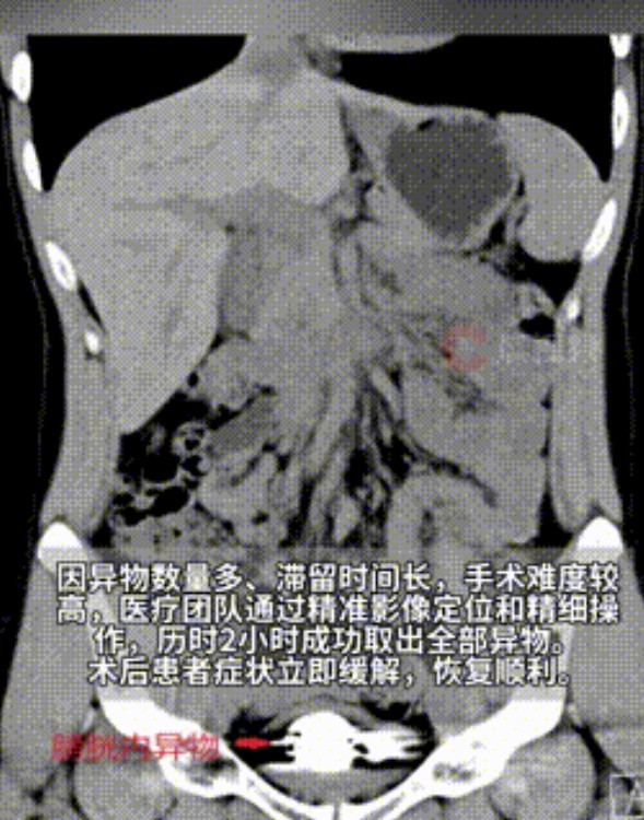 “还是年轻人玩得花！”湖南长沙，一00后小伙尿频尿痛1年之久，疼的受不了无奈就医
