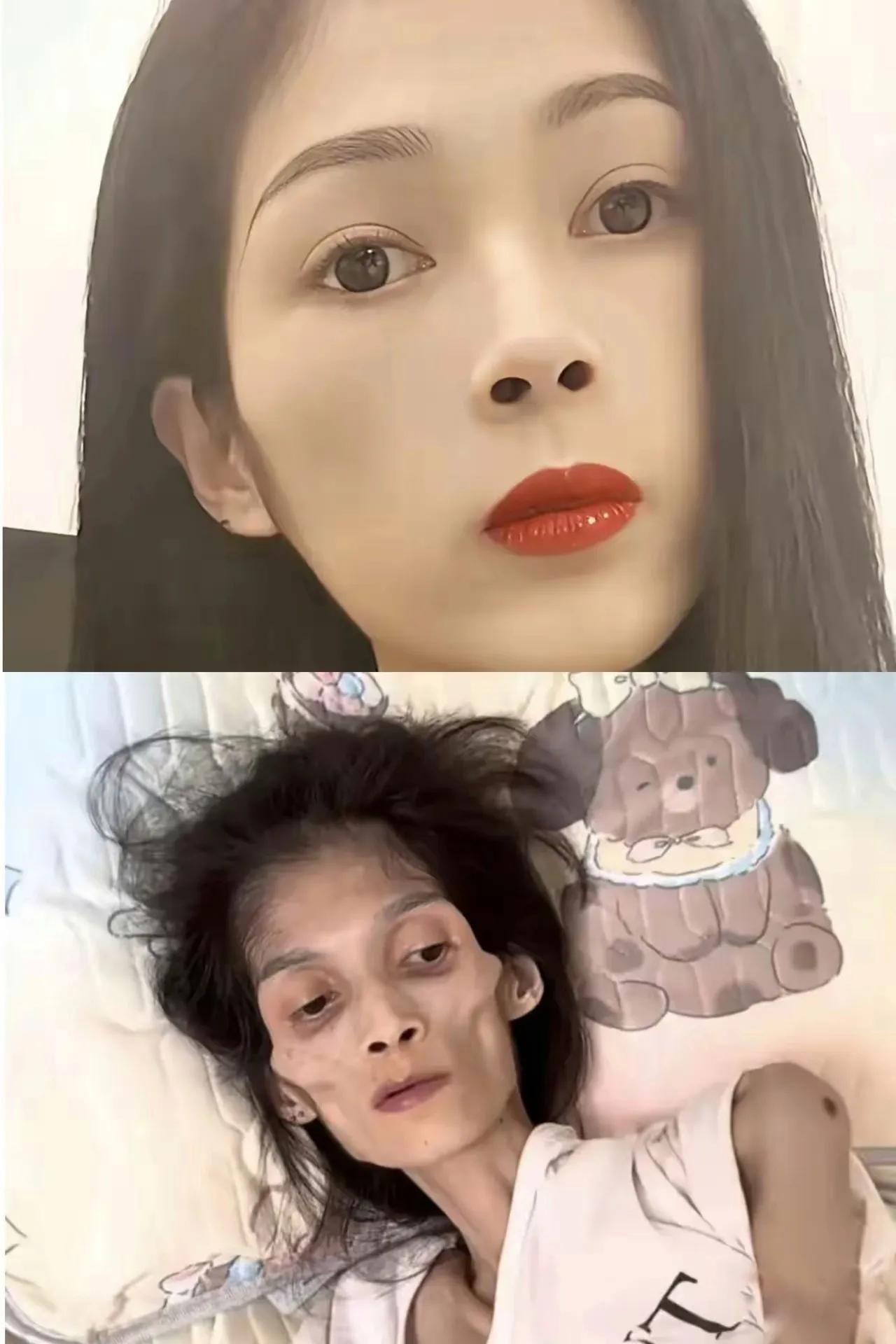 12月16日凌晨1时，27岁网红“巧巧妹妹”咽下最后一口气，去世时她仅有35斤！