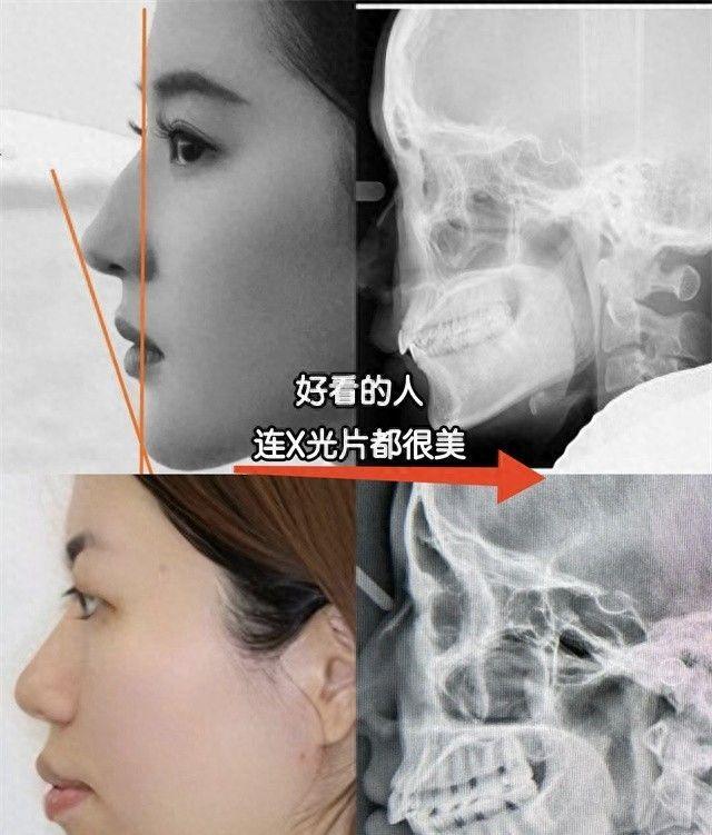 判断人美丑，骨相比皮相更重要？扒扒公认美人骨相，气质和颜值谁更胜一筹