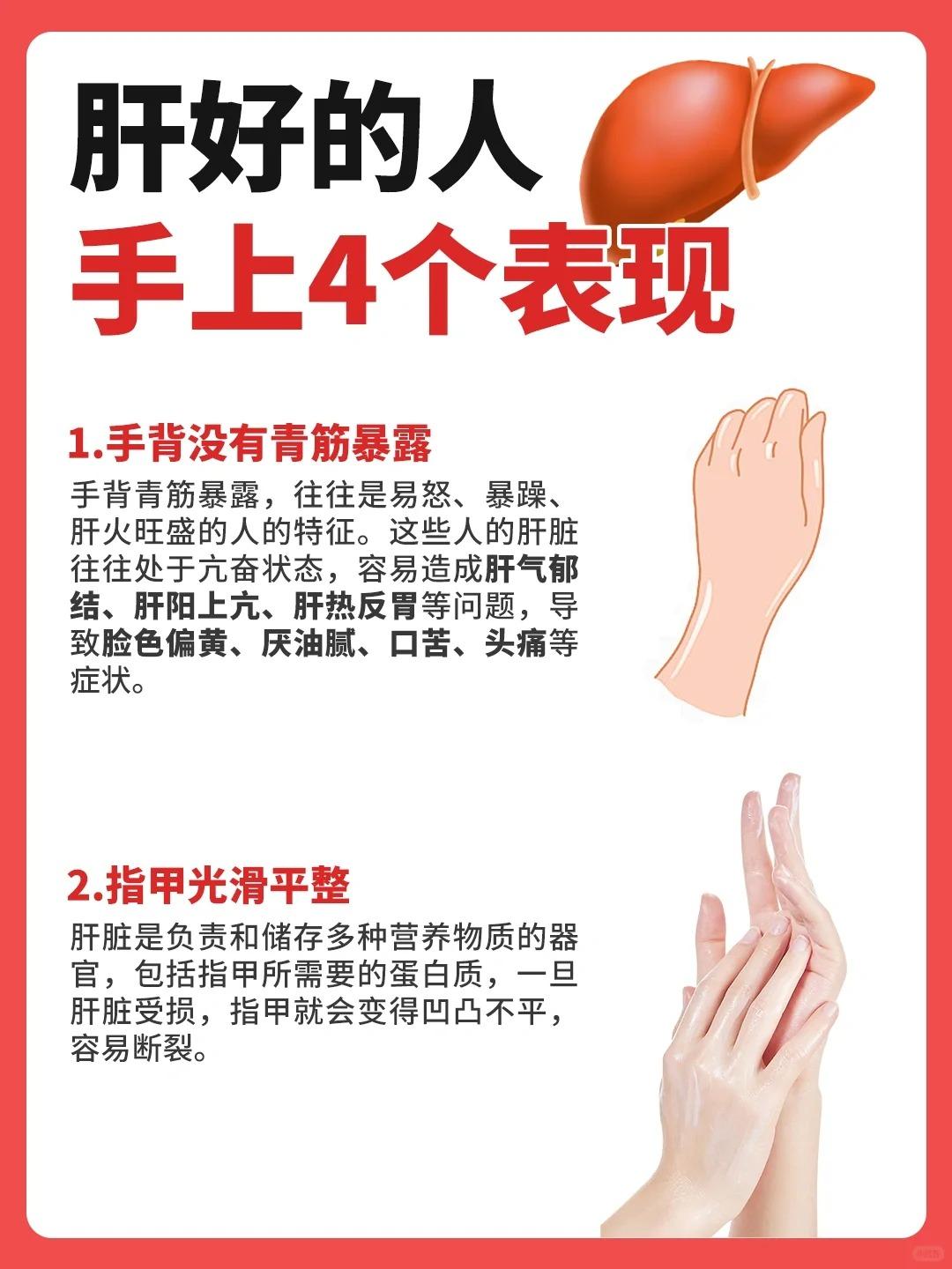 肝好的人，手上一般有4个表现！你有几个？