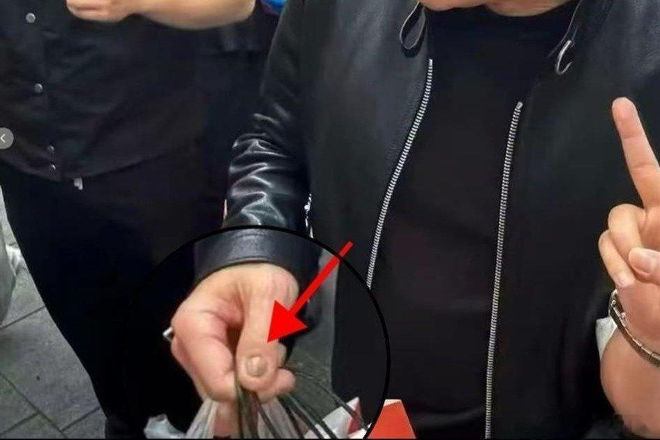 凤凰新闻【黄仁勋的指甲冲上热搜！高清镜头曝光，网友吵翻！医生：这6种情况都可能】