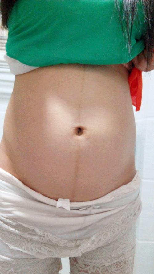 孕妇要做糖筛, 婆婆不让乱花钱, 孕妇水肿就医, 丈夫: 妈, 您后悔吗?