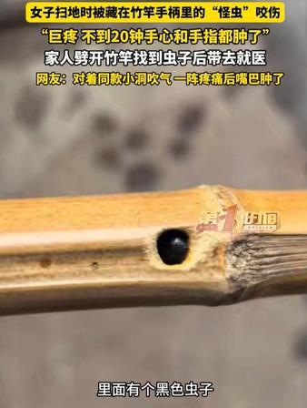 吓出一身冷汗！四川雅安女子在家扫地遭藏在竹扫把柄里的毒虫突袭，被蛰完才二十分钟，