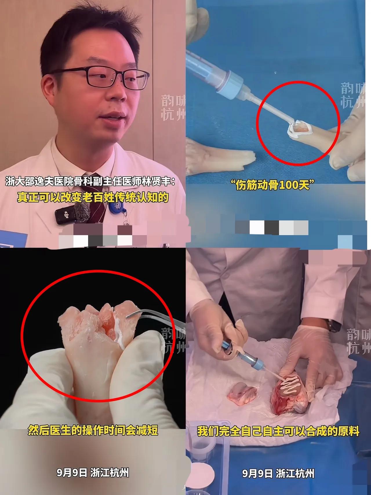 中国医疗又出王炸了！这次直接把全世界都给惊到了！浙江邵逸夫医院搞