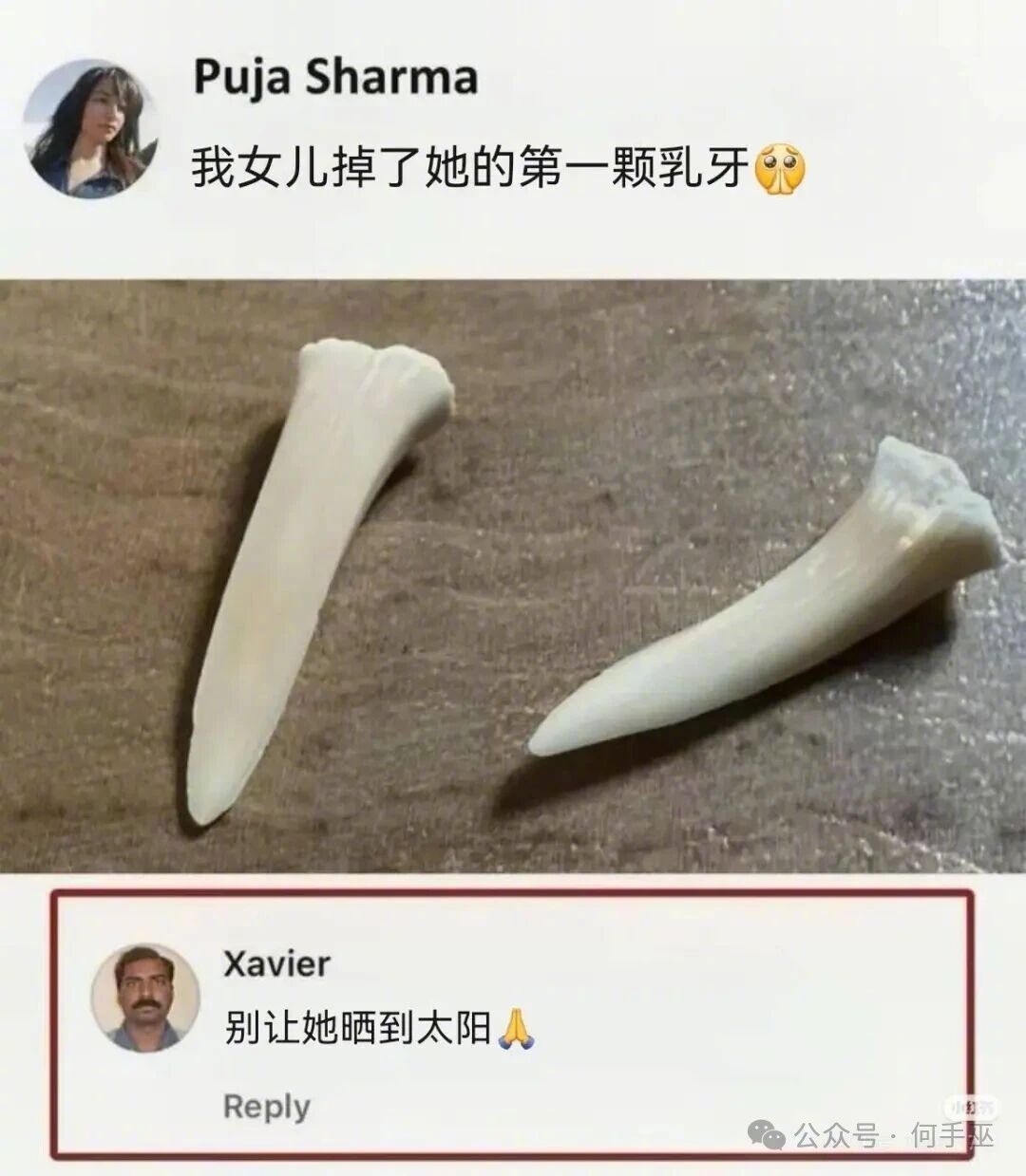 小虎牙蛮可爱的
