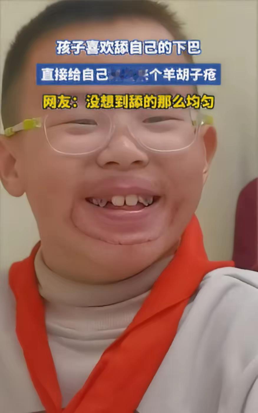 笑不活！浙江一男孩喜欢舔自己下巴，家长也没在意，觉得就是小孩闲得慌，结果，过一段