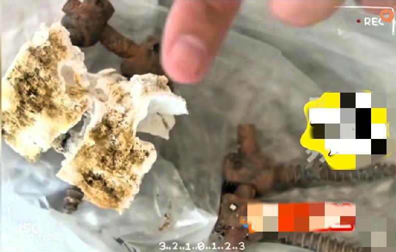 骨灰里的钢钉+2分钟监控空白，这事儿真不是“疏忽”能解释的！90岁没做过手