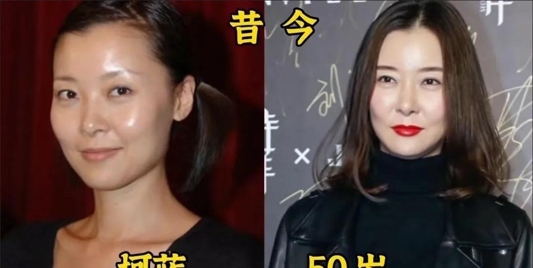 郝蕾年轻时候紧致细腻的肌肤，透着更加甜美与灵动的气息，让整个人的姿态都变的更加可