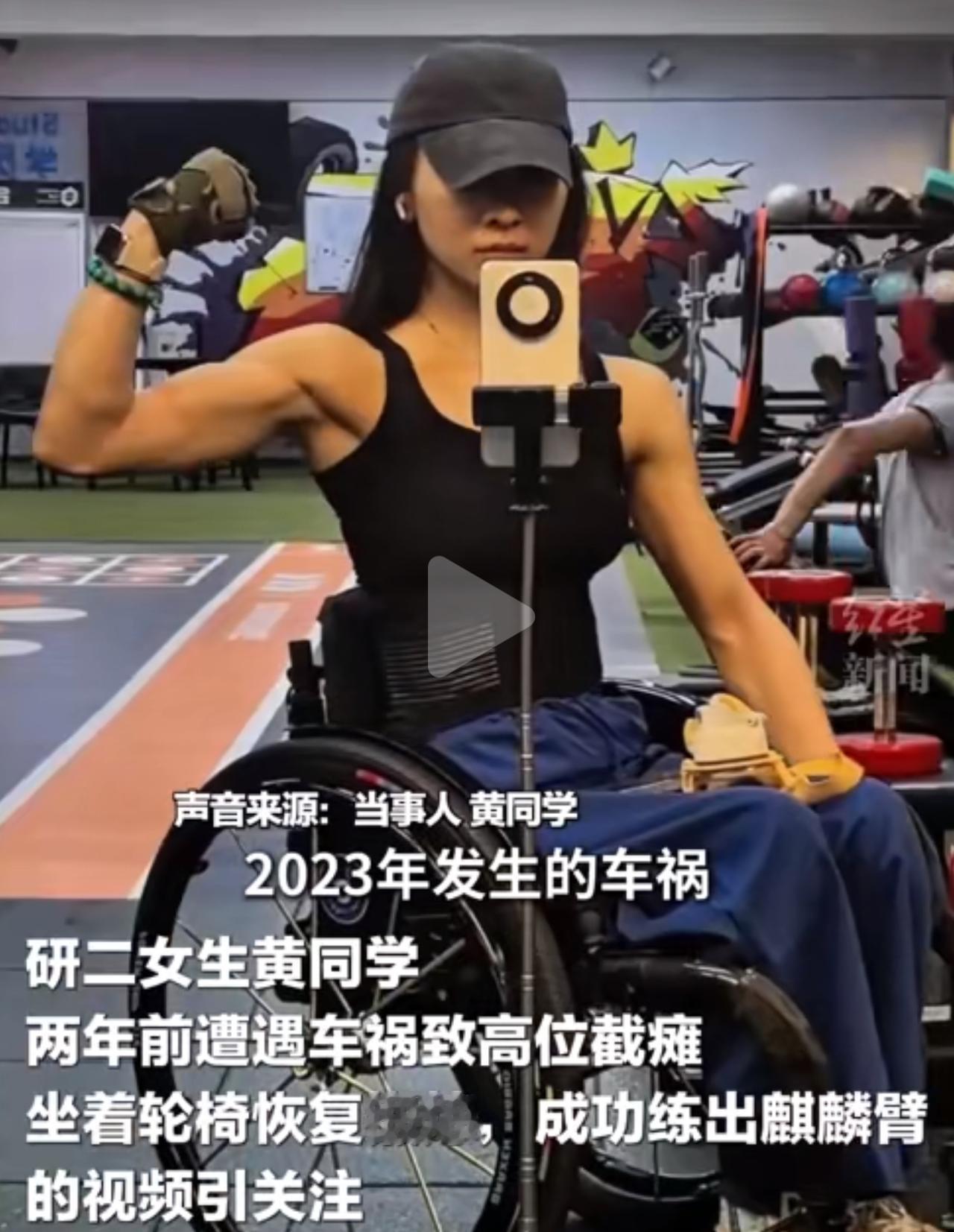 24岁研二的姑娘，之前胸椎被撞得爆裂骨折，胸口以下全没了知觉，谁能想到啊，现在愣