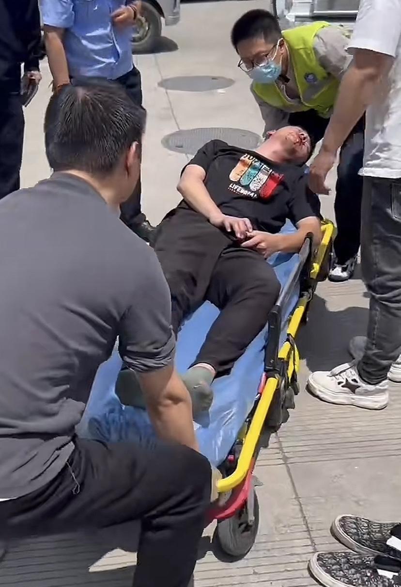 新能源车抢充电桩出事了，司机打架最终还是上了救护车。鼻子嘴巴都有血，估计鼻梁被打