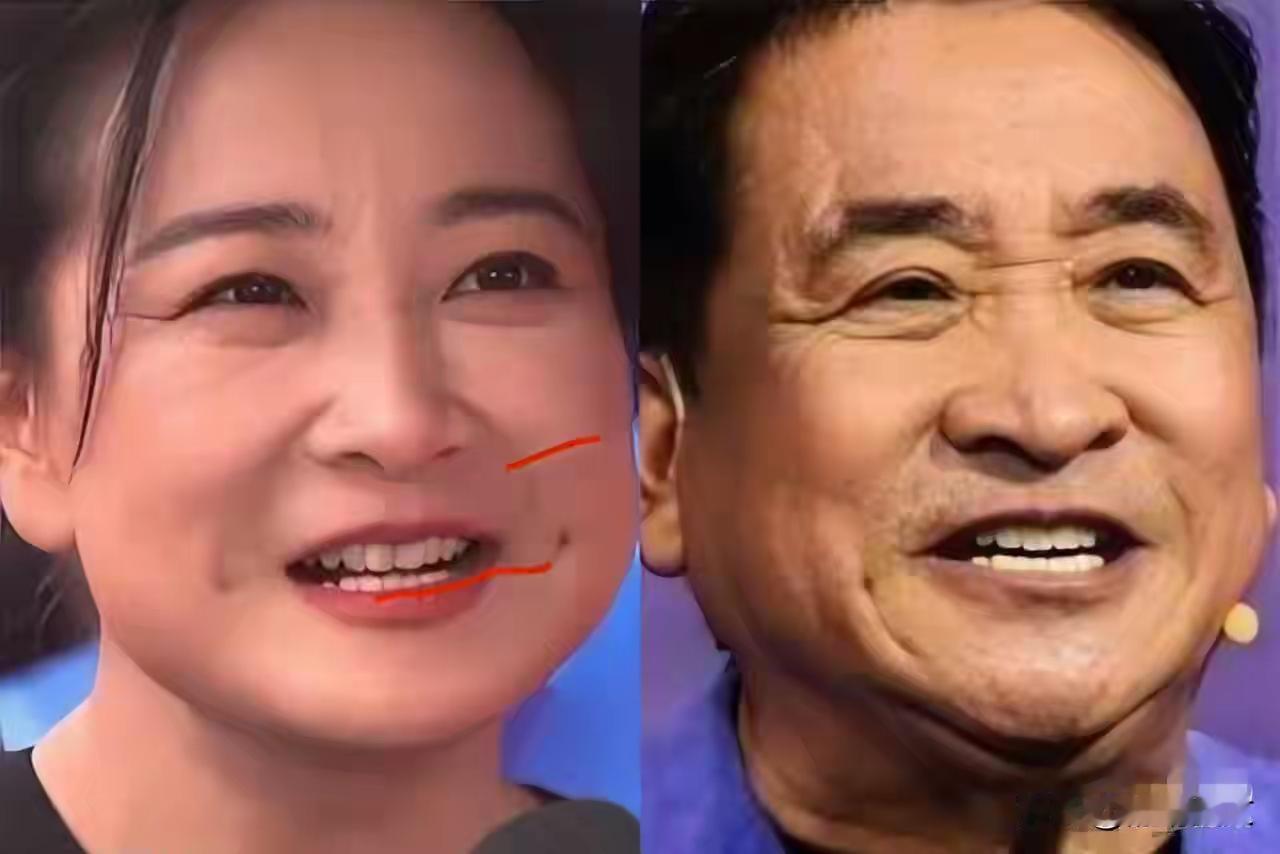 牢A说：凤姐在漂亮国没有被斩杀线斩杀，但代价是绝后！想问问大家：那