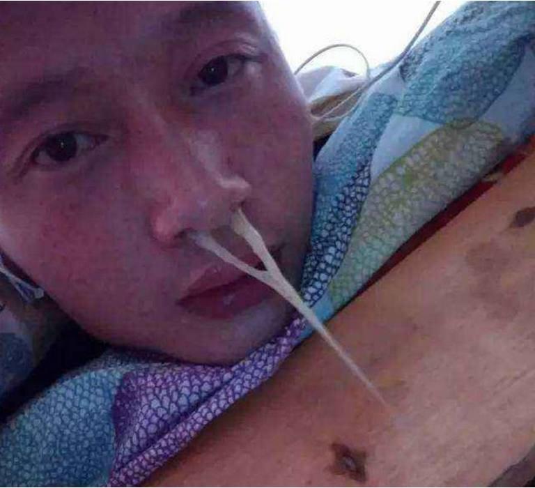 这1个民间土方治鼻炎, 现在还在用, 效果奇好, 已治愈数万人!