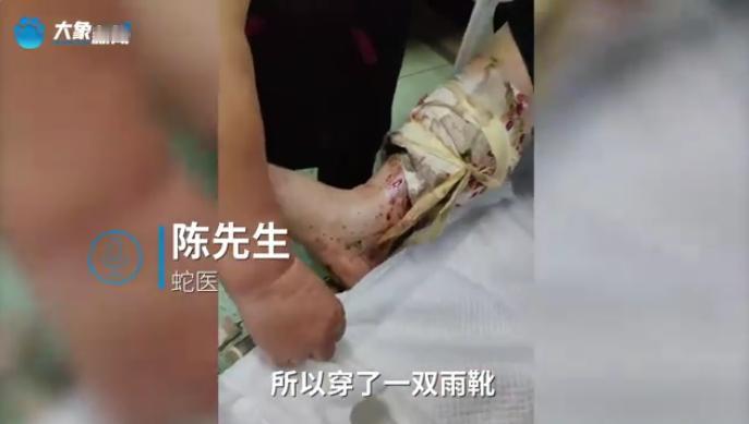 “无知真可怕！”9月15日，浙江温州，一女子去山里捡栗子时，担心被蛇咬伤，特地穿