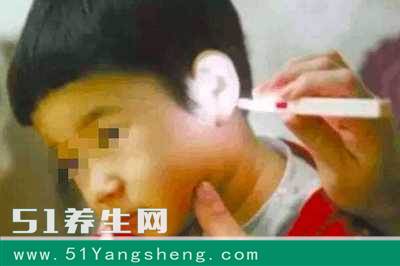 宝宝听力迟缓, 医院检查, 医生从他耳朵掏出这东西