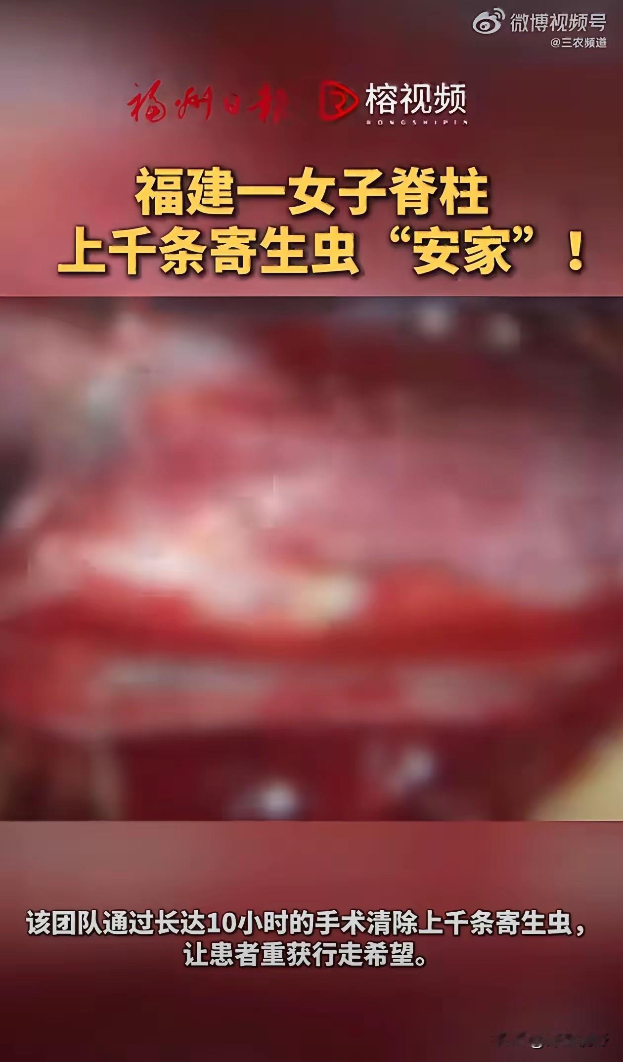 近日，福建福州发生了一起罕见的医疗事件，一位57岁的农村妇女李女士，在饱受病痛折
