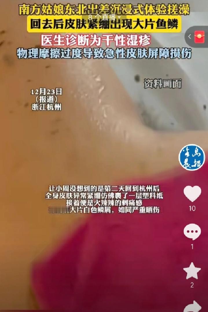 悲剧还是发生了!浙江杭州，一女子去东北出差，到澡堂体验了一次搓澡，结果次日全身皮